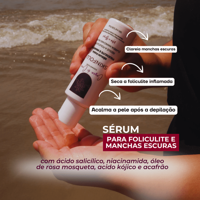 Tratamento Para Manchas de Foliculite Axilas Virilhas